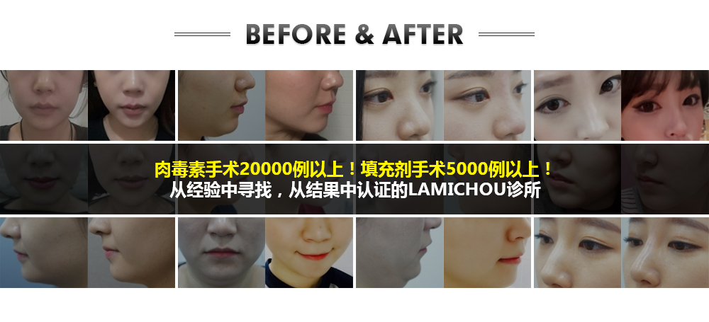 BEFORE & AFTER