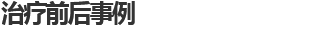 전후사례