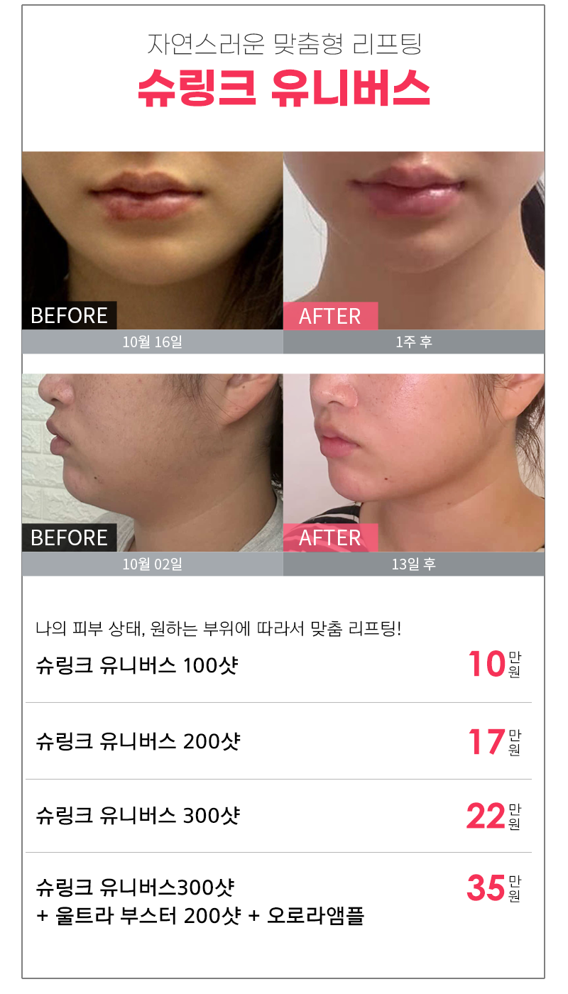 2512 카톡 이벤트03.png