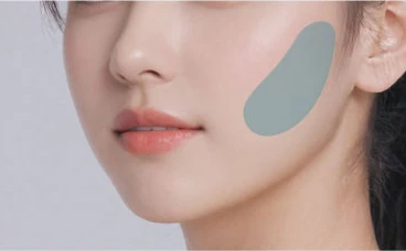 볼필러 시술 부위