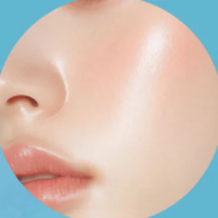 눈밑 필러 시술 부위 클로즈업