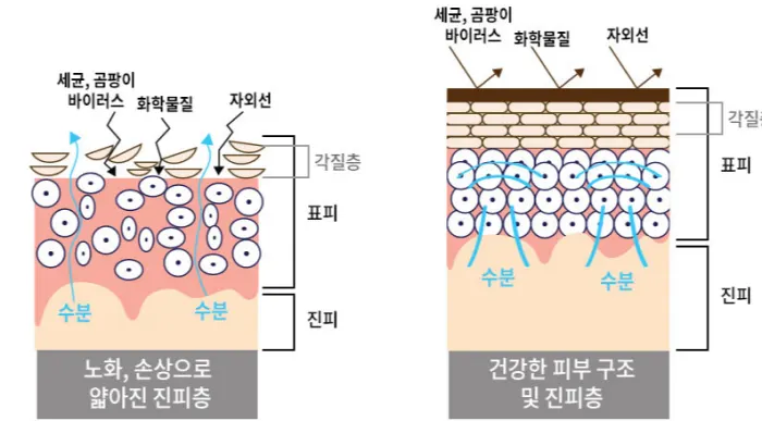 리쥬란힐러 시술 원리